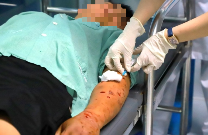 Nam thanh niên 28 tuổi bị chó hàng xóm cắn với hàng trăm vết thương trên cơ thể - Ảnh 1.
