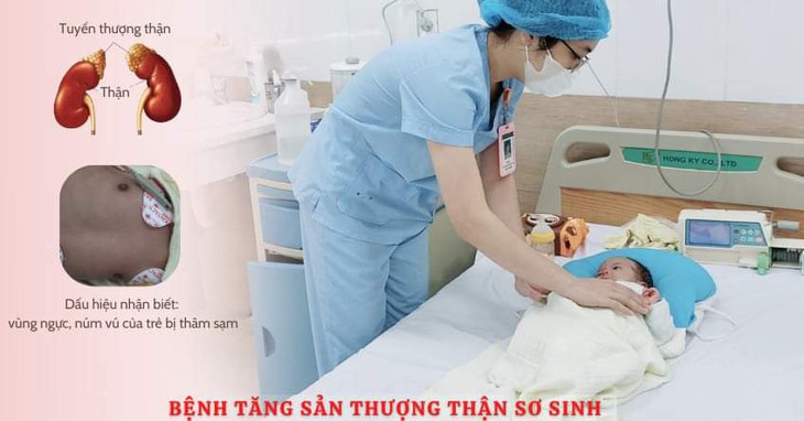 Thót tim ca cứu sống bé sơ sinh 1 tháng tuổi bị tăng sản thượng thận bẩm sinh - Ảnh 1.