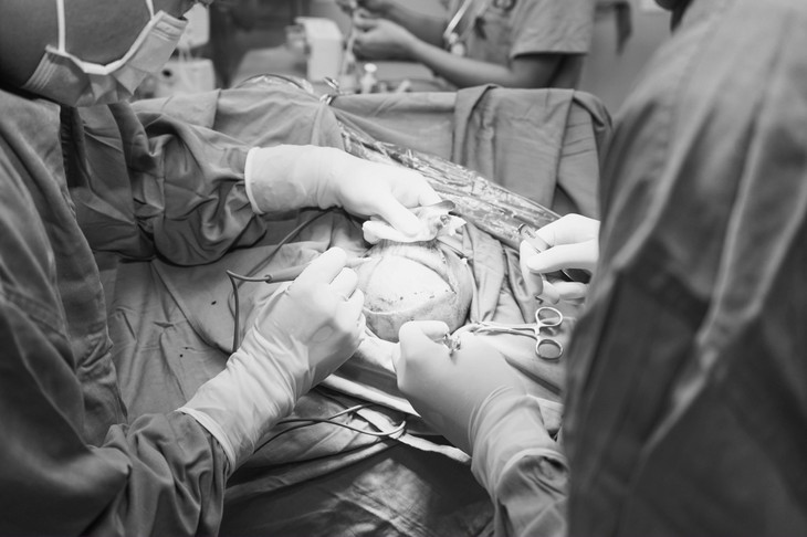 Cứu sống bé sơ sinh người Mông 26 ngày tuổi bị xuất huyết não - Ảnh 2. Cứu sống bé sơ sinh người Mông 26 ngày tuổi bị xuất huyết não - Ảnh 2.