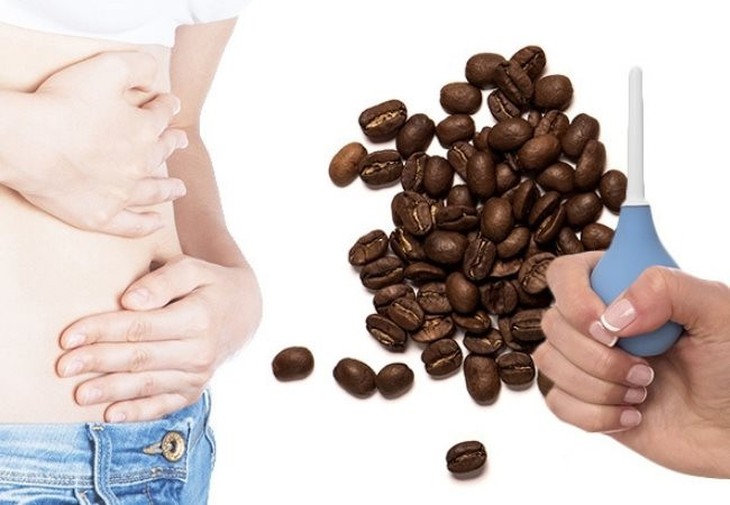 Người phụ nữ bị vỡ hậu môn do tháo thụt bằng cà phê, chuyên gia y tế cảnh báo - Ảnh 2. Người phụ nữ bị vỡ hậu môn do tháo thụt bằng cà phê, chuyên gia y tế cảnh báo - Ảnh 2.