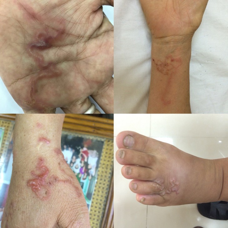 Tác hại khủng khiếp từ thói quen ăn thịt lợn, bò tái - Ảnh 3.