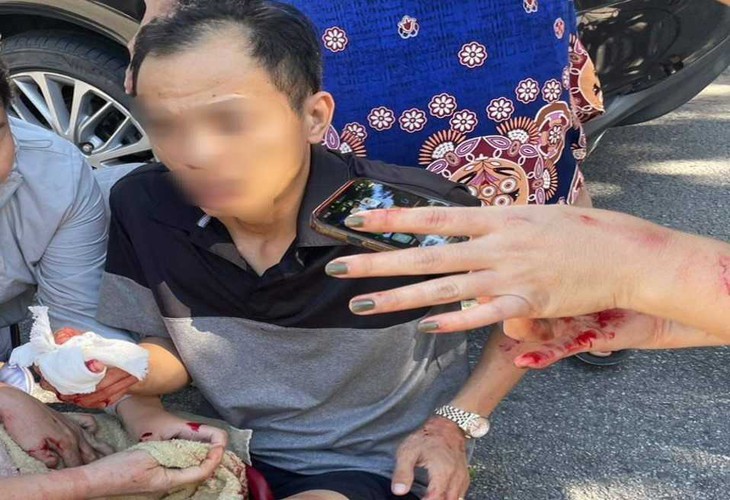 Một thành viên công ty khai thác mỏ bị chém trước cửa nhà - Ảnh 1.