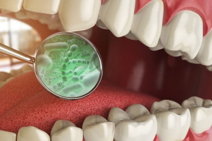 Vi khuẩn trong miệng có ảnh hưởng đến sức khỏe cần biết - Ảnh 1.