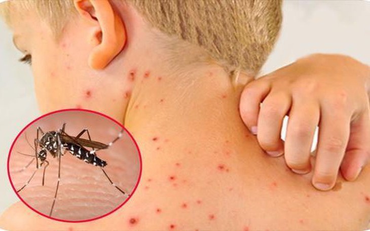 Ghi nhận 57.295 ca mắc sốt xuất huyết, 13 trường hợp tử vong, Bộ Y tế yêu cầu xử lý triệt để các ổ dịch