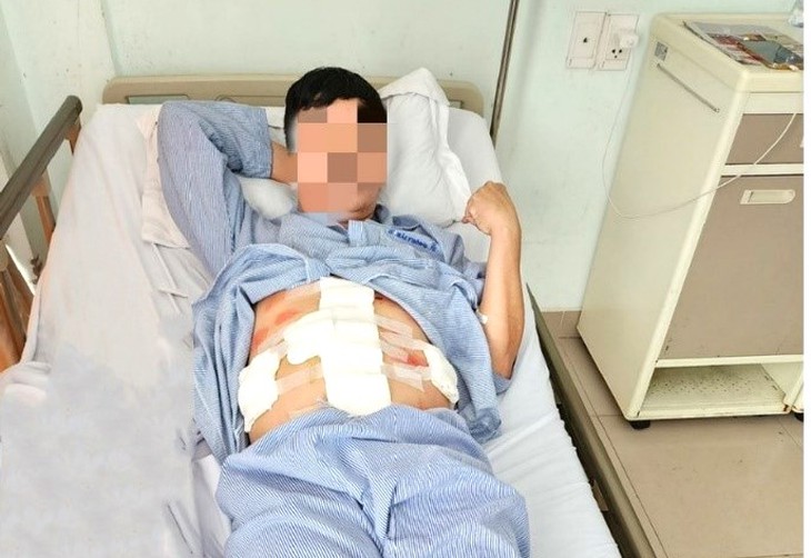 Bác sĩ Hải Phòng cứu người đàn ông 46 tuổi bị đạn bắn xuyên thấu bụng - Ảnh 1. Bác sĩ Hải Phòng cứu người đàn ông 46 tuổi bị đạn bắn xuyên thấu bụng - Ảnh 1.