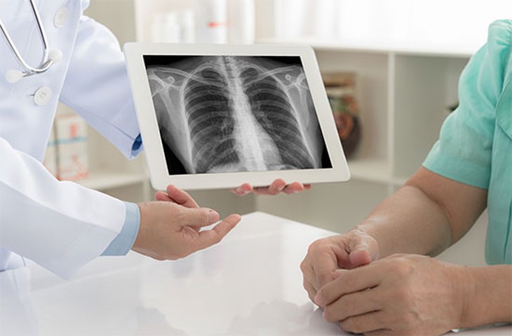 Nhập viện do tự ý điều trị viêm phổi, bác sĩ cảnh báo thói quen nhiều người thường mắc - Ảnh 3. Nhập viện do tự ý điều trị viêm phổi, bác sĩ cảnh báo thói quen nhiều người thường mắc - Ảnh 3.