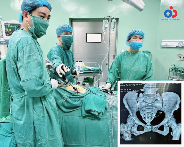 2 phụ nữ suýt thủng ruột do vòng tránh thai "chạy" lạc chỗ  - Ảnh 1.