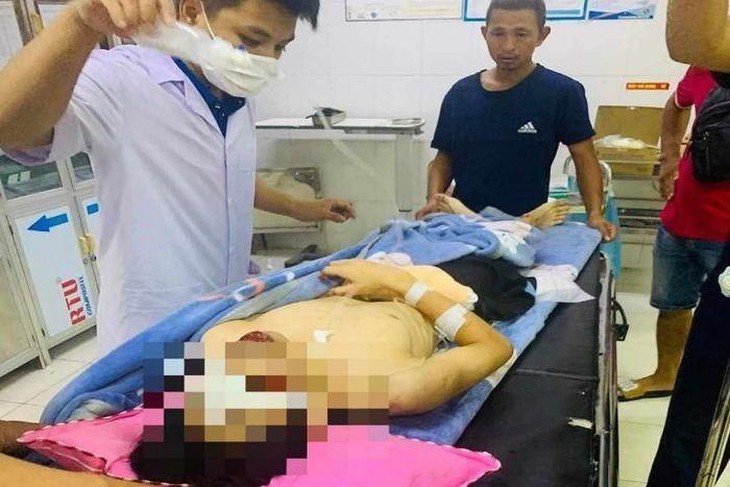 Nam sinh gần đứt lìa bàn tay sau tiếng nổ lớn - Ảnh 1.