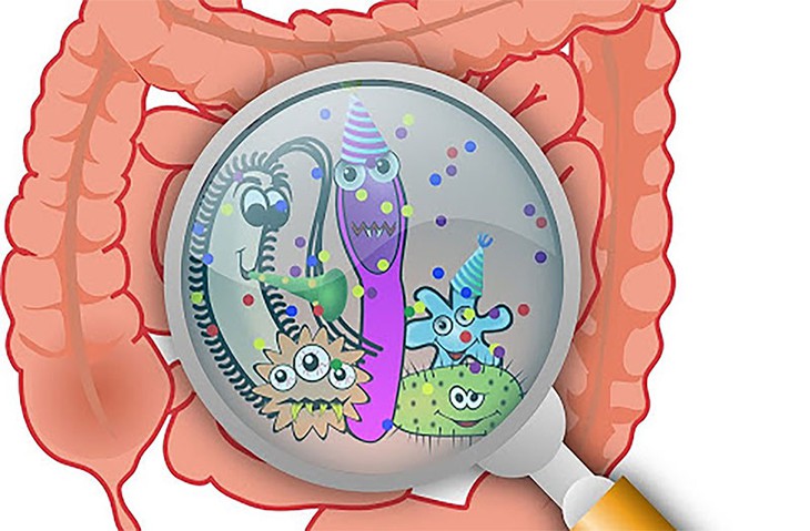 3 nhóm thực phẩm có lợi cho sức khỏe đường ruột - Ảnh 2.