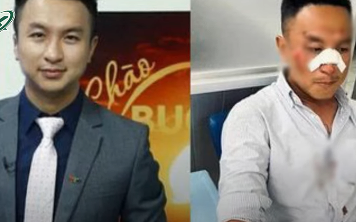 Cựu MC “Chào buổi sáng” VTV1 bị tai nạn giao thông đến biến dạng khuôn mặt