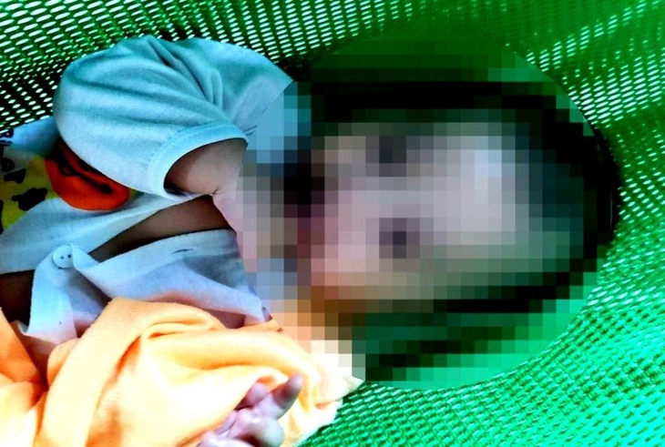 Bé trai 6 tháng tuổi bị bảo mẫu bạo hành dập não đã qua đời - Ảnh 1.
