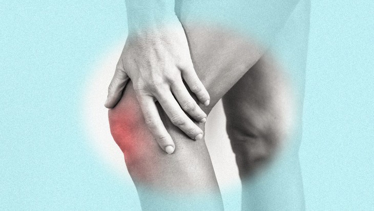 Viêm xương khớp gây đau nhức, thuốc nào giảm đau hiệu quả? - Ảnh 1. Viêm xương khớp gây đau nhức, thuốc nào giảm đau hiệu quả? - Ảnh 1.