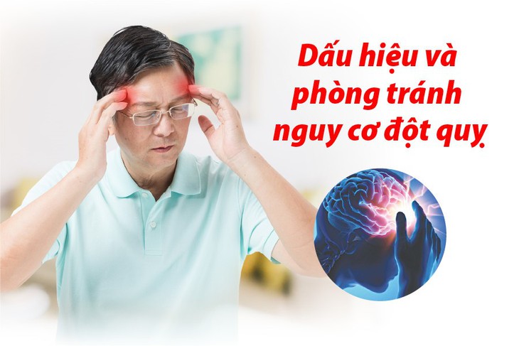 4 dấu hiệu cảnh giác và 4 bước phòng ngừa nguy cơ đột quỵ - Ảnh 1.