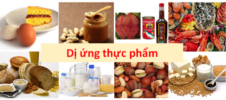 Ảnh minh họa Ảnh minh họa