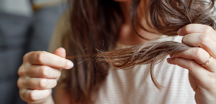 Rụng tóc mùa thu, khắc phục thế nào? - Ảnh 1.