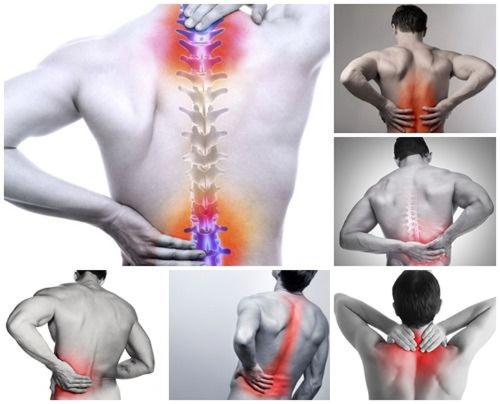 4 nguyên tắc để phòng ngừa thoái hóa cột sống cần biết - Ảnh 1.