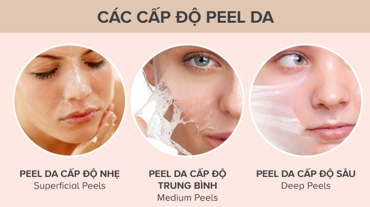 Các bước peel da làm trắng da, những điều cần biết - Ảnh 1.