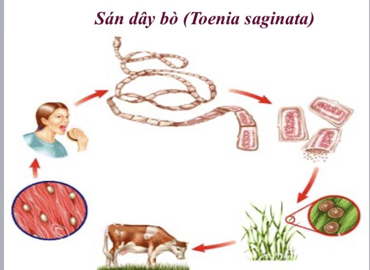 Bệnh sán dây bò là một bệnh rất dễ mắc phải, ảnh hưởng đến sức khỏe người lao động do thói quen ăn uống nhất là ăn gỏi bò, bò tái, nước lẩu bò chưa sôi…