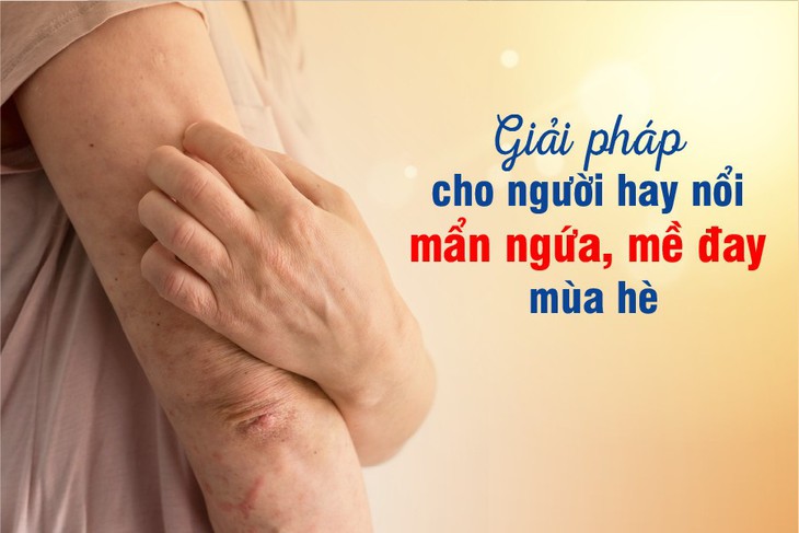 Giải pháp cho người thường xuyên nổi mẩn ngứa, mề đay mùa hè - Ảnh 1. Giải pháp cho người thường xuyên nổi mẩn ngứa, mề đay mùa hè - Ảnh 1.