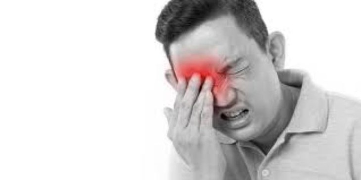 Những người bị viêm xoang thường có các triệu chứng tăng thêm và cảm thấy khó chịu vào mùa mưa. Ảnh minh họa