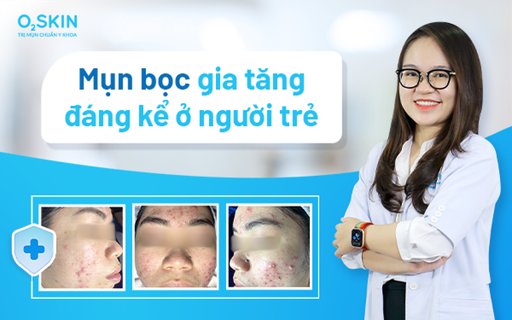 Mụn bọc gia tăng đáng kể ở người trẻ - Ảnh 1. Mụn bọc gia tăng đáng kể ở người trẻ - Ảnh 1.