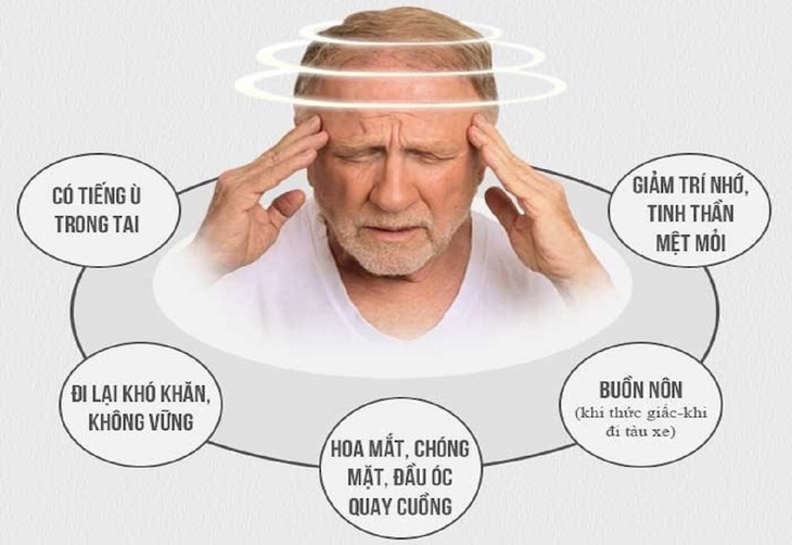 Những điều cần biết khi điều trị rối loạn tiền đình - Ảnh 1.