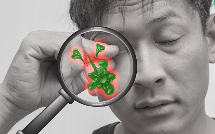 Quảng Bình ghi nhận hơn 3. 400 trường hợp trẻ bị đau mắt đỏ