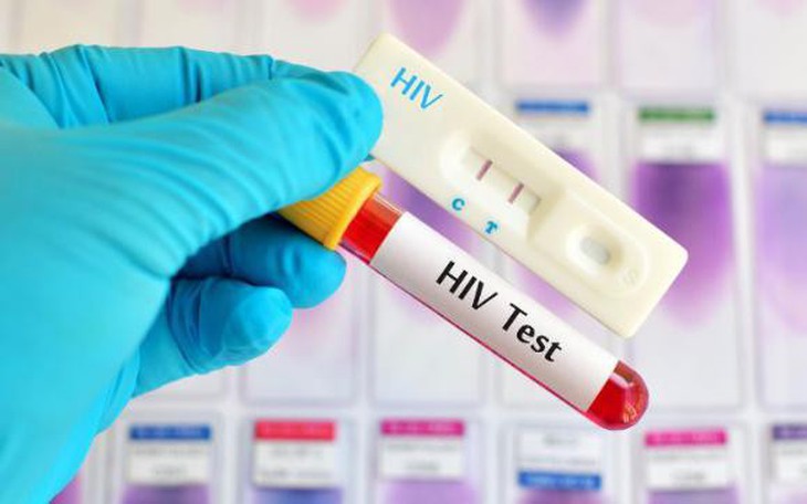 Tăng cường hoạt động tư vấn xét nghiệm HIV tại cộng đồng