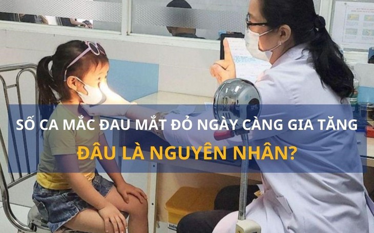 Số ca đau mắt đỏ ngày càng gia tăng: Đâu là nguyên nhân? Đau mắt đỏ là gì?
