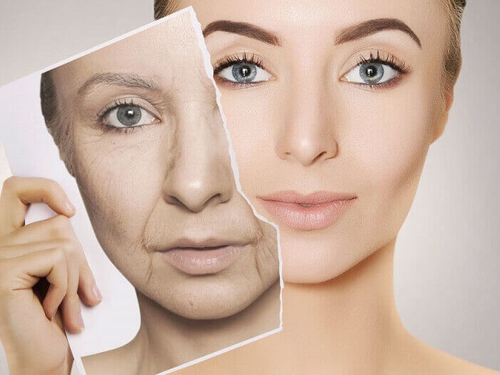 Nâng cơ mặt chảy xệ: Laser hay cấy chỉ? - Ảnh 1.