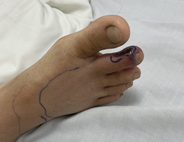 Nhiều trường hợp bị rắn độc cắn, chuyên gia chỉ cách phòng ngừa và xử lý - Ảnh 2.