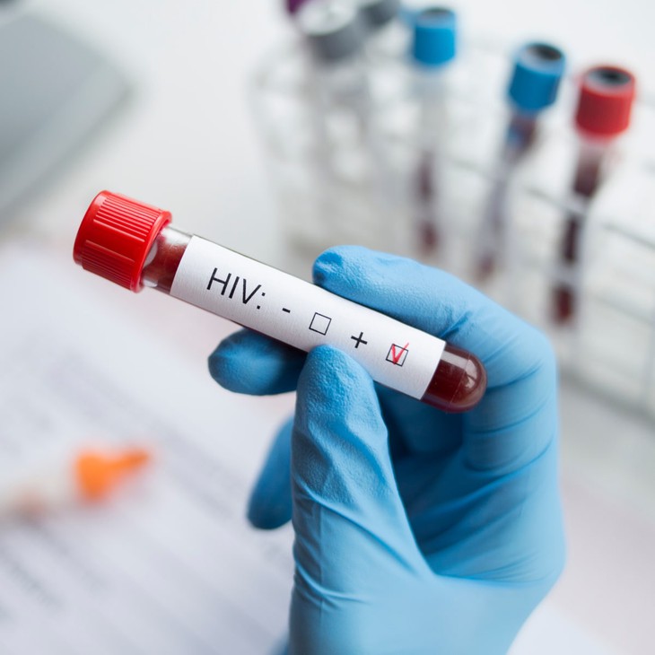 4 giải pháp thực hiện mục tiêu xét nghiệm HIV đến năm 2030- Ảnh 1. 4 giải pháp thực hiện mục tiêu xét nghiệm HIV đến năm 2030- Ảnh 1.