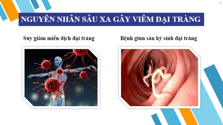 Khám phá bí mật về giải pháp hỗ trợ cho người viêm đại tràng - Ảnh 1. Khám phá bí mật về giải pháp hỗ trợ cho người viêm đại tràng - Ảnh 1.