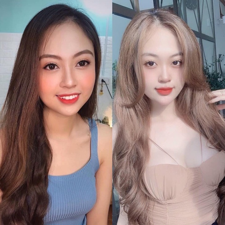 Nguyên nhân dẫn đến tình trạng nâng ngực bị bao xơ - Ảnh 2.