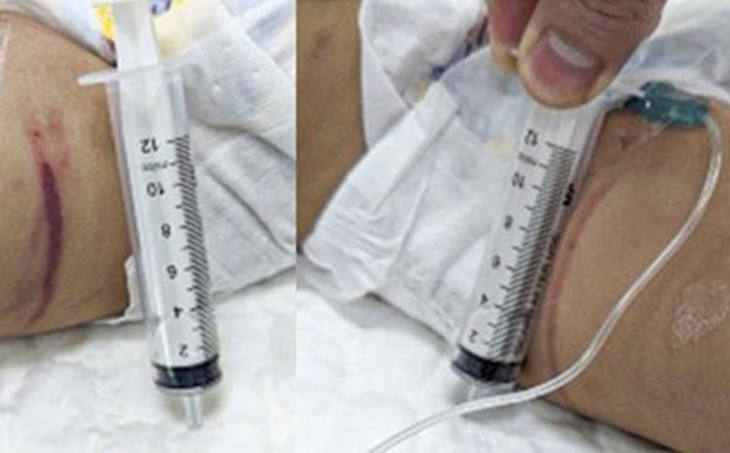 Bé gái 1 tuổi bị vợ chồng trông giữ trẻ bạo hành bằng những phương thức khiến ai nghe cũng rợn người - Ảnh 2.