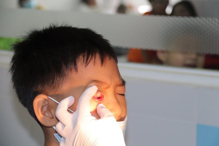 Đã xác định được tác nhân gây dịch đau mắt đỏ tại TPHCM - Ảnh 1. Đã xác định được tác nhân gây dịch đau mắt đỏ tại TPHCM - Ảnh 1.