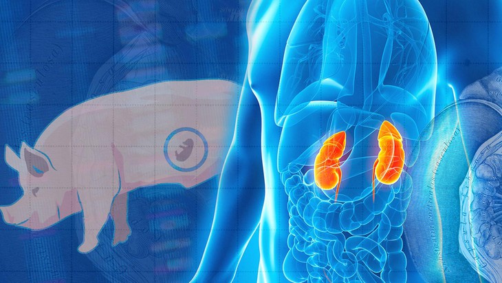 Những bước tiến trong nuôi cấy thận trên phôi lợn để ghép cho người - Ảnh 2.
