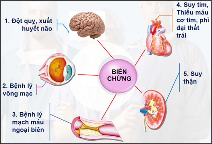 Duy trì hoạt động thể chất giúp giảm huyết áp cao- Ảnh 1. Duy trì hoạt động thể chất giúp giảm huyết áp cao- Ảnh 1.