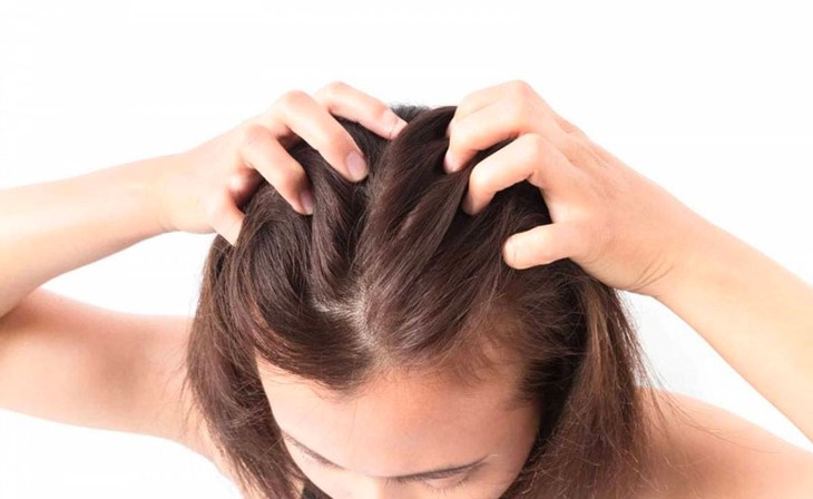 Bổ sung chất nào tại nhà giúp tóc khỏe, giảm gãy rụng?- Ảnh 1.