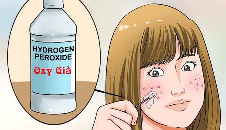 Cách sử dụng oxy già trong chăm sóc da- Ảnh 1. Cách sử dụng oxy già trong chăm sóc da- Ảnh 1.