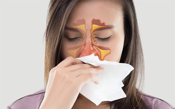 Các loại viêm xoang thường gặp và triệu chứng