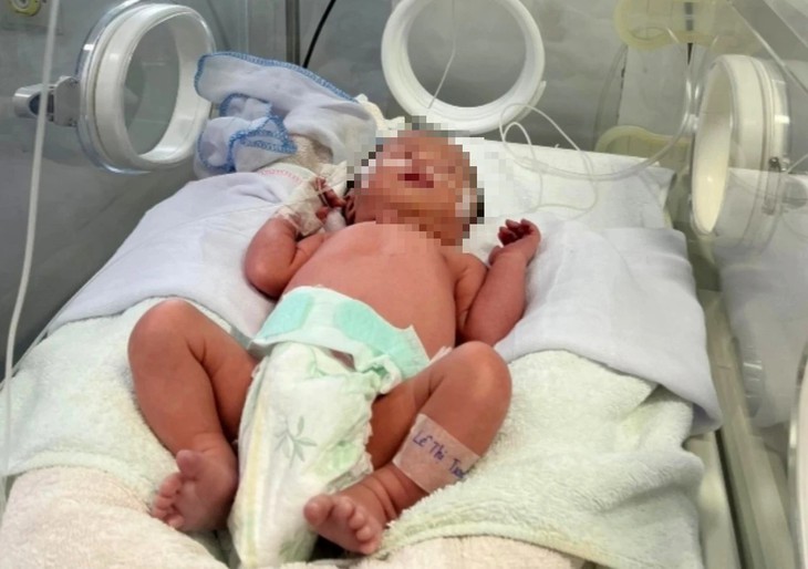Bác sĩ kể chuyện cứu sản phụ nguy kịch mang trong mình 2 'thiên thần nhỏ'- Ảnh 3.