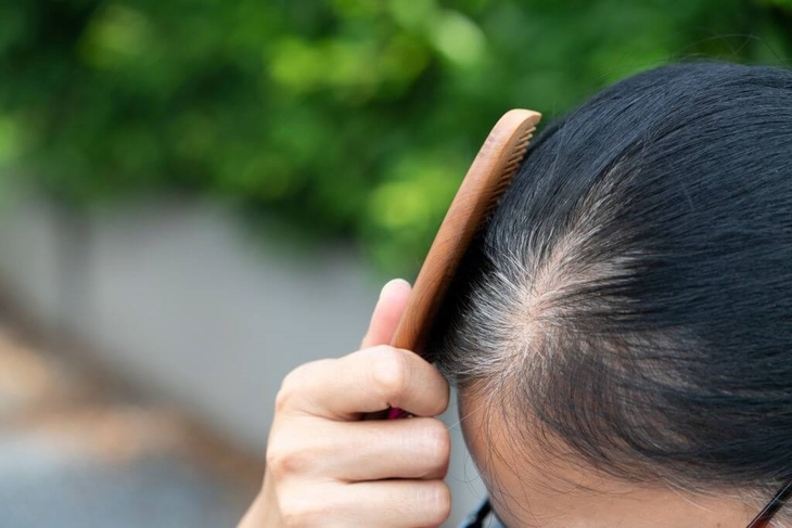 Tóc bạc sớm xảy ra có thể xuất phát từ nhiều nguyên nhân khác nhau. Ảnh minh họa