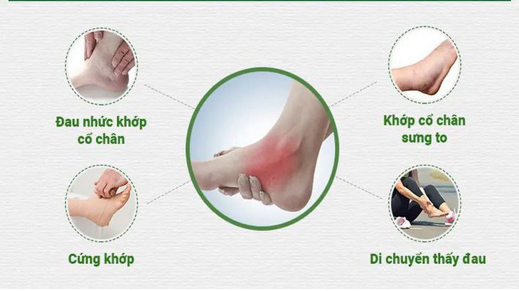 Đau khớp cổ chân dai dẳng cảnh giác với viêm khớp cổ chân- Ảnh 1.