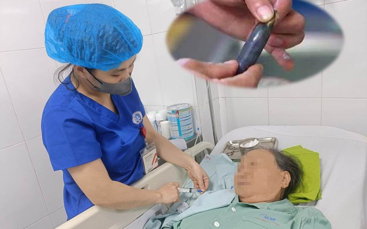 Ăn mật cá trôi để bổ mắt, cụ bà ngộ độc phải cấp cứu