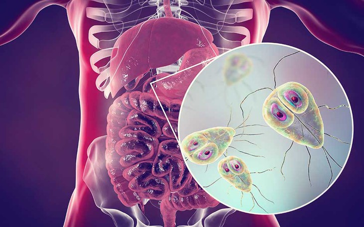 6 dấu hiệu nhiễm ký sinh trùng ở người