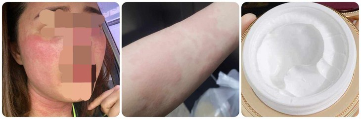 Làm đẹp đón Tết và cái kết 'đắng'- Ảnh 1. lam-dep-don-tet