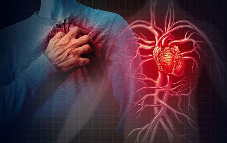 3 điều cần lưu ý khi dùng thuốc aspirin để bảo vệ tim mạch