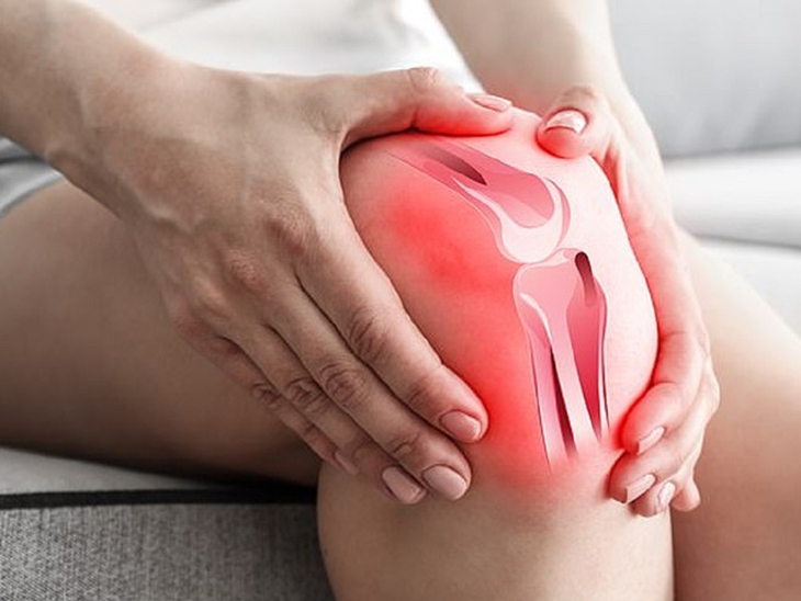 Đau khớp gối khi thời tiết lạnh phải làm gì?- Ảnh 1.