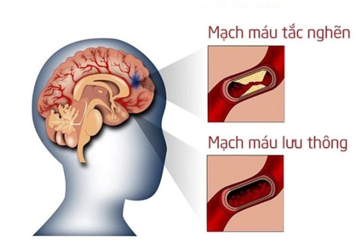 Thảo dược mới hỗ trợ phòng chống huyết ứ- Ảnh 1. Thảo dược mới hỗ trợ phòng chống huyết ứ- Ảnh 1.